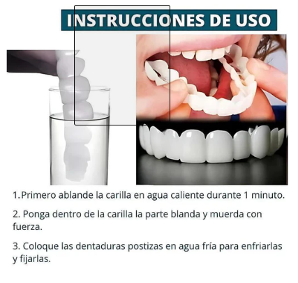 Carillas Dentales + REGALO GRATIS 🎁